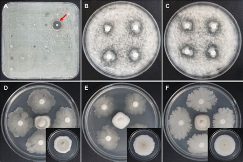 In Vitro Screening Of Antagonistic Activity Of Rhizosphere Soil