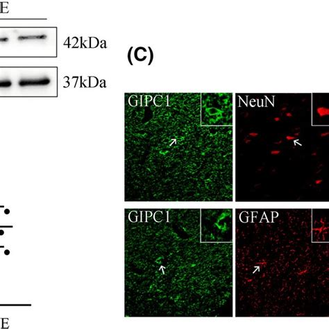 Expression And Location Of GAIP Interacting Protein C Terminus 1