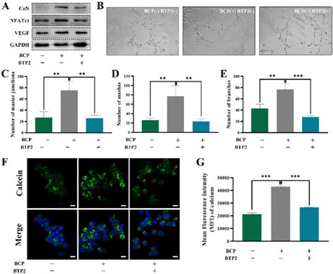 A Activation Of Nfatc Vegf Pathway After Stimulation From Of Three