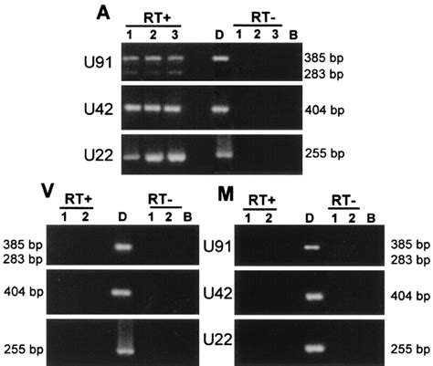 Reverse Transcription Pcr Analysis For Hhv 6 Transcripts Mrna Was