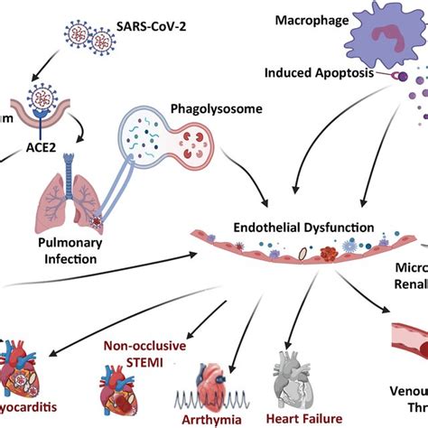 Schematic Summary Of The Covid 19 Microangiopathic Consequences Leading