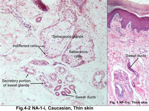 Pin By Katherine MacDonald On Science Thick Skin Sweat Gland