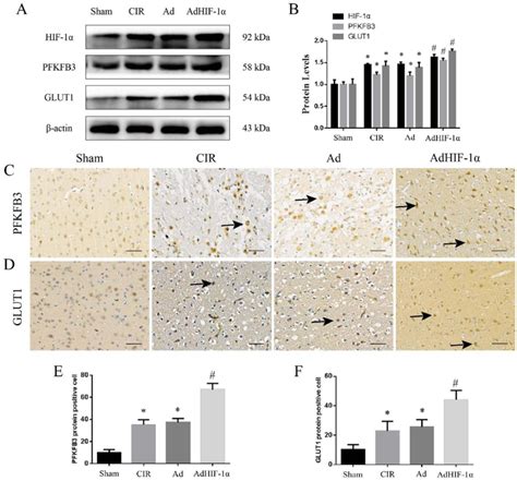 The Expression Of Hif Pfkfb And Glut A Wb Results Of Hif