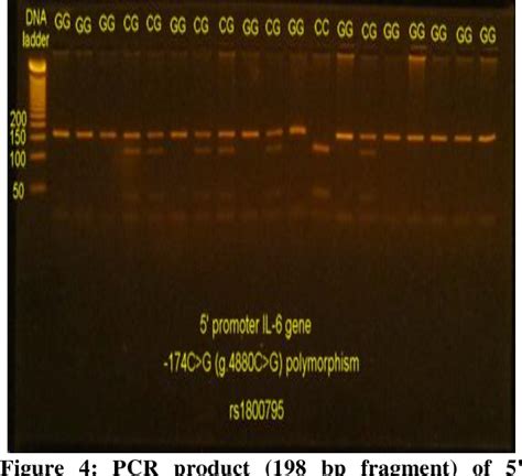 Figure 1 From THE ROLE OF ANTI INFLAMMATORY INTERLEUKINE 4 590C T AND