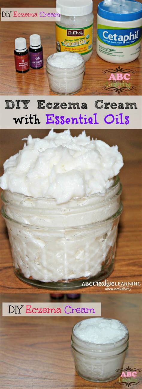 DIY Homemade Eczema Cream with Essential Oils - Simply Today Life