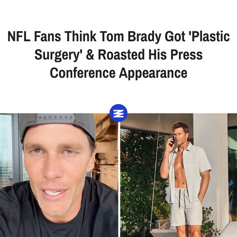 Nfl Fans Think Tom Brady Got Plastic Surgery Roasted His Press