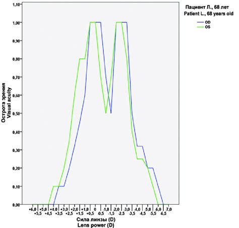 Defocus Curves In Binocular Implantation Of Acrysof Restor Sn Ad Iol