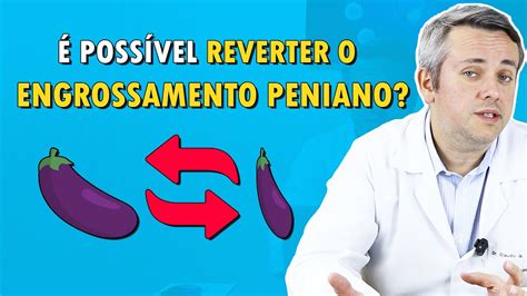 Como Reverter O Engrossamento Peniano Dr Claudio Guimarães Youtube