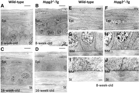 Tem Of The Corneal Epithelium Tem Images Show Ultrastructural Features