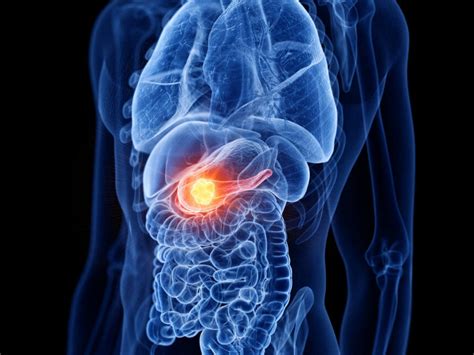 Adagrasib Shows Promising Activity in Gastrointestinal Cancers - Cancer ...