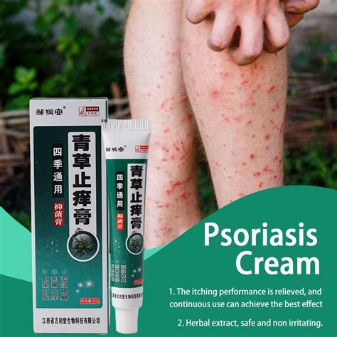 Psoriasis Cream Relief Itching Skin Antipruritic Cream Herbal Antibacterial Cream Rash Scaling