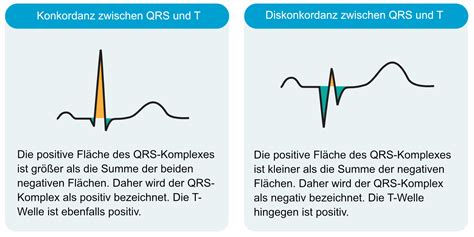 Kardiale Elektrophysiologie Aktionspotential Automatizit T Und