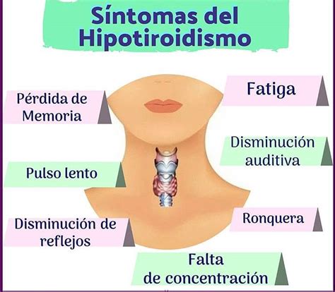 Hipotiroidismo síntomas Prevención y Tratamiento 2020