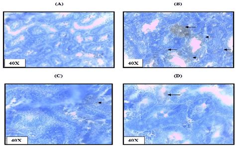 Apoptosis Determination Tunel Staining Assay Demonstrating Apoptosis