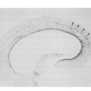 In Situ Hybridization Analysis Of RAGS MRNA Expression In The