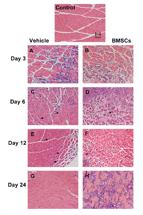 Transplantation Of Bmscs Impaired Skeletal Muscle Regeneration