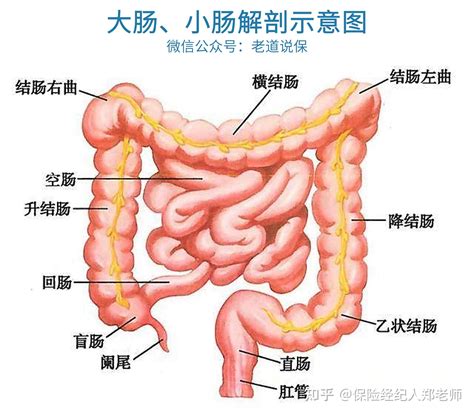 结肠息肉、直肠息肉，可以买保险吗？ 知乎