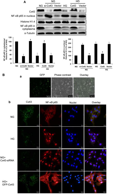 Cx43 regulates high glucose induced NF κB nuclear translocation A