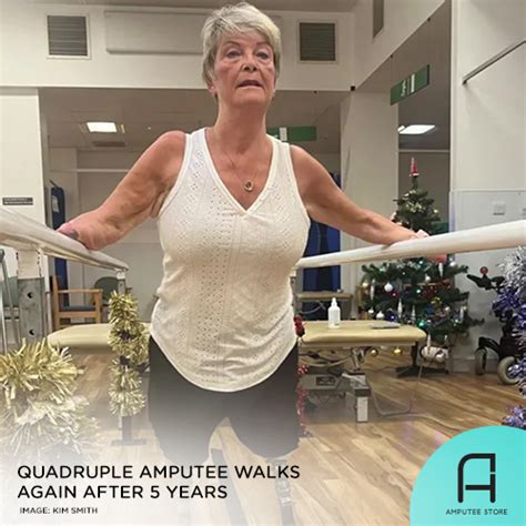 Quadruple Amputee Walks Again After 5 Years | Amputee Store