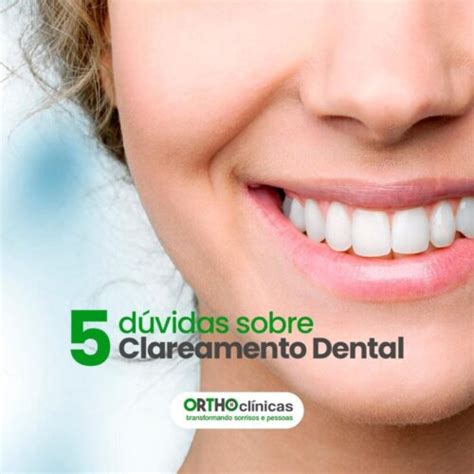 5 dúvidas sobre o clareamento dental