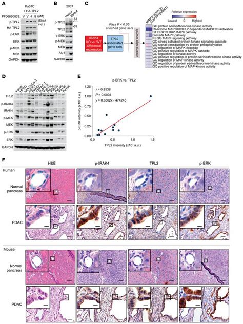 Jci Tpl2 Enforces Ras Induced Inflammatory Signaling And Is Activated