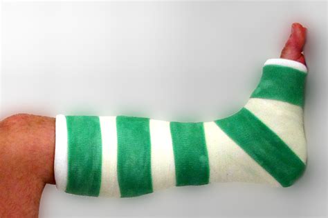 Gay Cast Fetish Lemmy NSFW