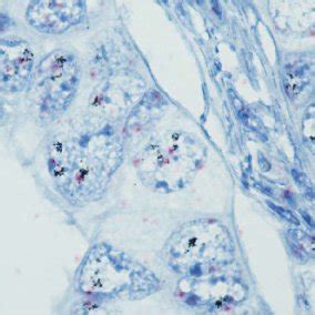 Dual Color In Situ Hybridization Human Epidermalgrowth Factor