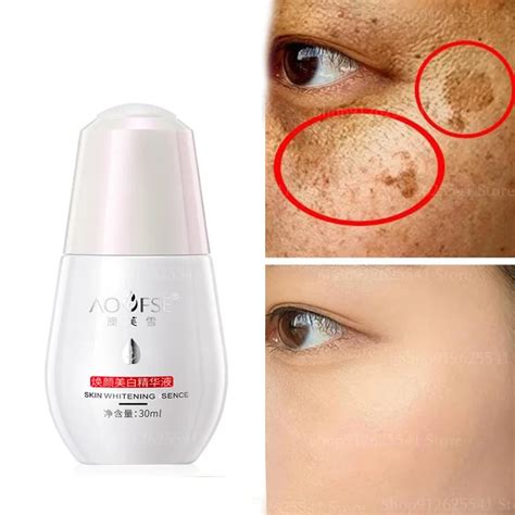 Ml Whitening Face Serum Freckle Removing Essence Improve Redness