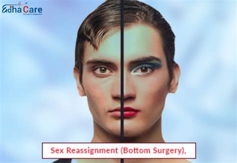 Sex Reassignment Treatment Sex Reassignment Surgery Edhacare