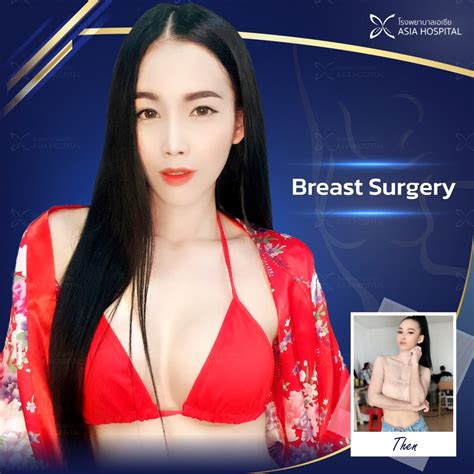 Asia Cosmetic Hospital Plastic Surgery Thailand