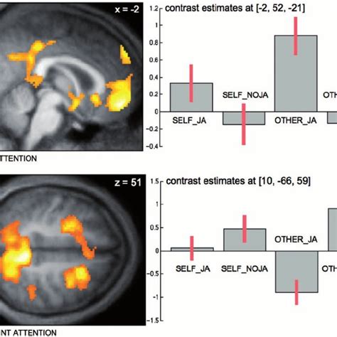 Neural Correlates Of Joint Attention Task A Differential Increase