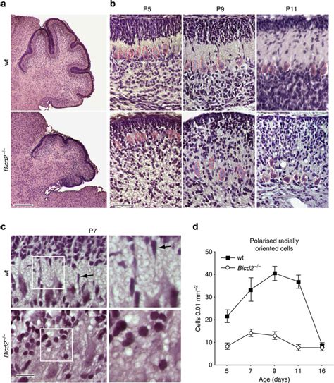 No Radial Granule Cell Migration In Bicd2 Cerebellar Cortex Ac