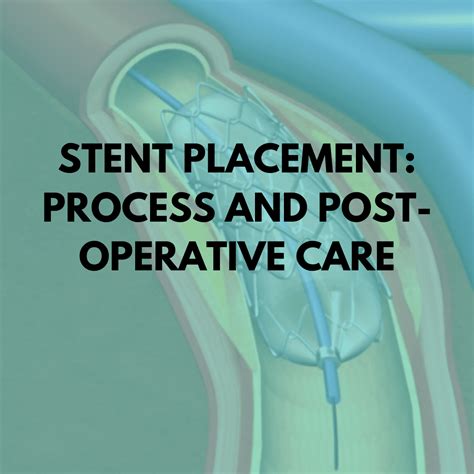 Stent Placement Process And Post Operative Care