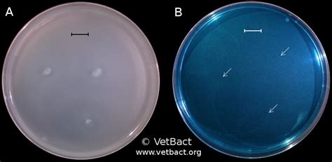 Salmonella Enterica Subsp Enterica