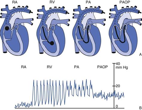 Hemodynamic Monitoring Thoracic Key