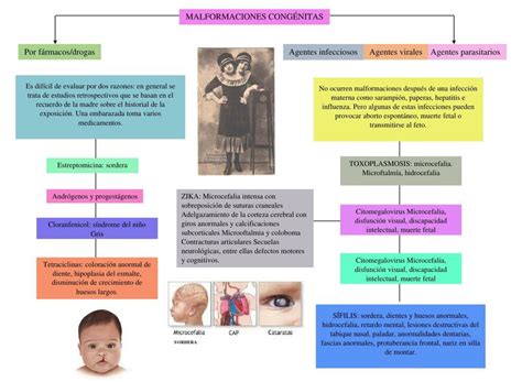 Malformaciones Cong Nitas El Rinc N M Dico Udocz