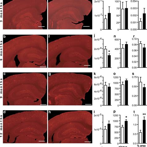 Amyloid Plaque Burden In The Hippocampus Of App Swe Ps And App Swe