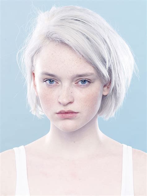 Unique Beauty Of A Girl With Albinism And Heterochromia Artofit