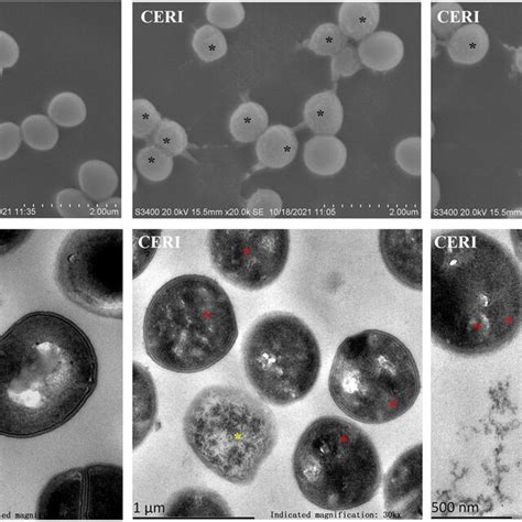 Membrane Disruption Of Ceri By Sem And Tem Observation S Aureus Atcc