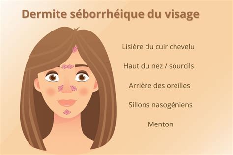 Dermite S Borrh Ique Du Visage Adoptez La Bonne Routine