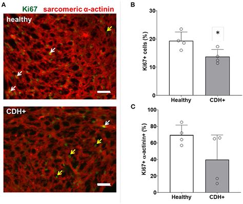 Frontiers Extracellular Matrix And Cyclic Stretch Alter Fetal