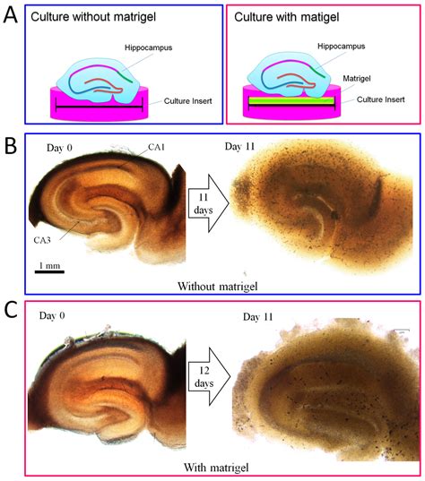 Ijms Free Full Text Human Dental Pulp Cells Differentiate Toward