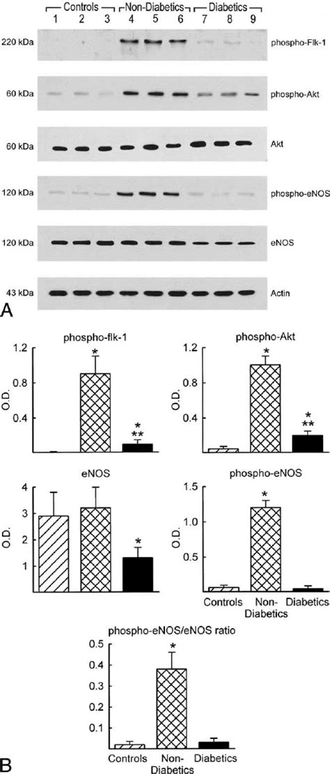 A Representative Western Blot Showing Phosphoflk 1 And Akt And Download Scientific Diagram