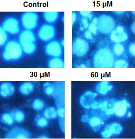 Oridonin Induces Apoptosis In The U Os Cells As Indicated By Dapi