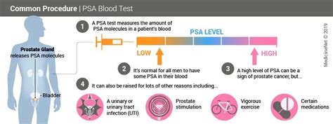 Prostate Specific Antigen Psa Test Results Levels And Ranges