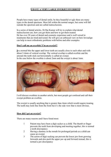 Overjet Overbite Pdf