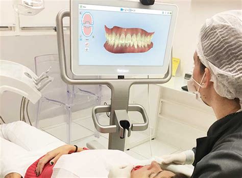 Scanner Intraoral Itero Realizamos O Escaneamento D Dos Seus Dentes