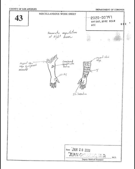 Kobe Bryant Autopsy: Addressing the Conspiracy Theories - lvxblr9