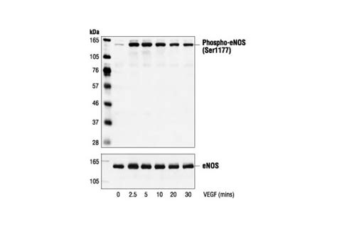 Phospho Enos Ser1177 Antibody Cell Signaling Technology