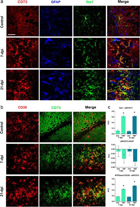 Identification Of Cells That Upregulate EN CD73 In The Hippocampal